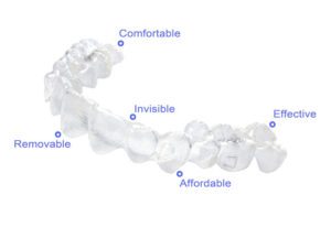 Advantages of invisalign