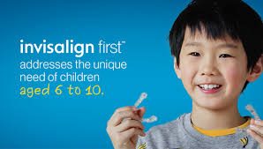 Invisalign first for kids 